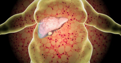 Depozitarea și mobilizarea lipidelor