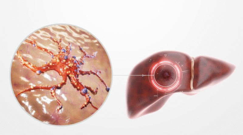 Dereglările metabolismului aminoacizilor